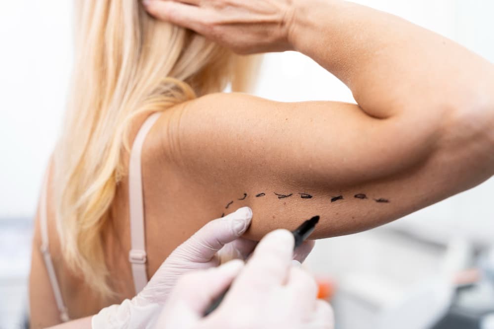 deri altı implant